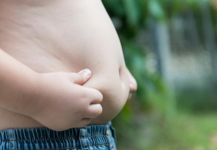 Overweight